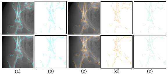 Robust and Accurate Multi-View 2D/3D Image Registration with Differentiable X-Ray Rendering and Dual Cross-View Constraints representative figure